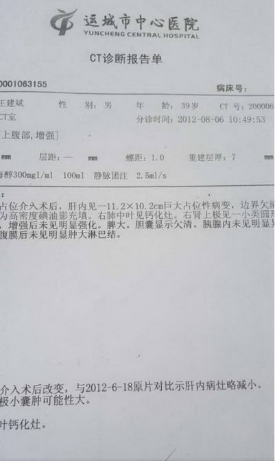 纯中药治疗癌症——中医治癌专家王建斌