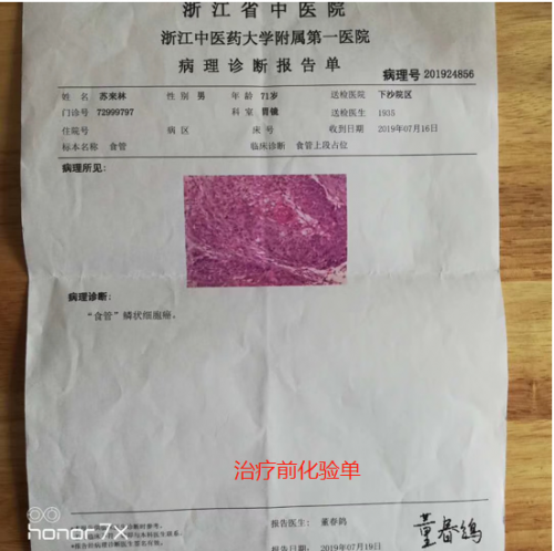 中医传承人刘帅-中药炮制治肿瘤缓解病人痛苦