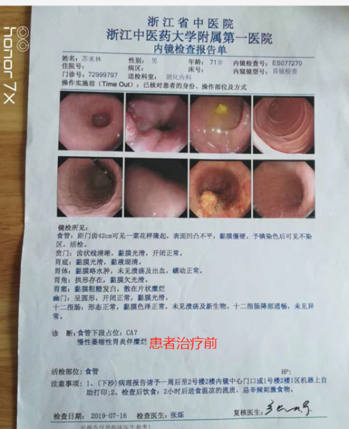 中医传承人刘帅-中药炮制治肿瘤缓解病人痛苦