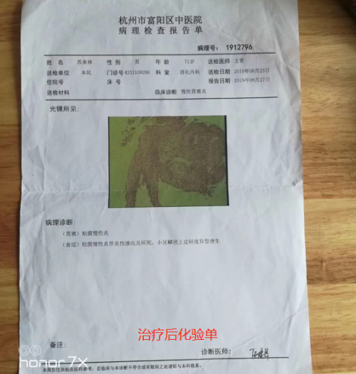 中医传承人刘帅-中药炮制治肿瘤缓解病人痛苦