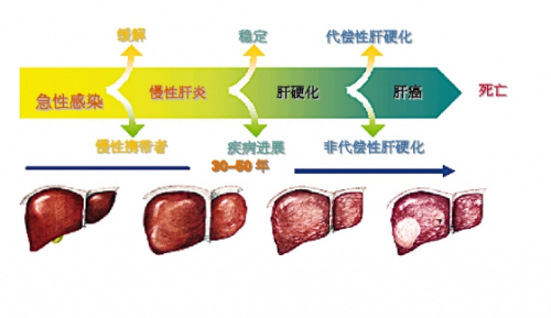 中草药良方治愈肝病-间医师杨雄树