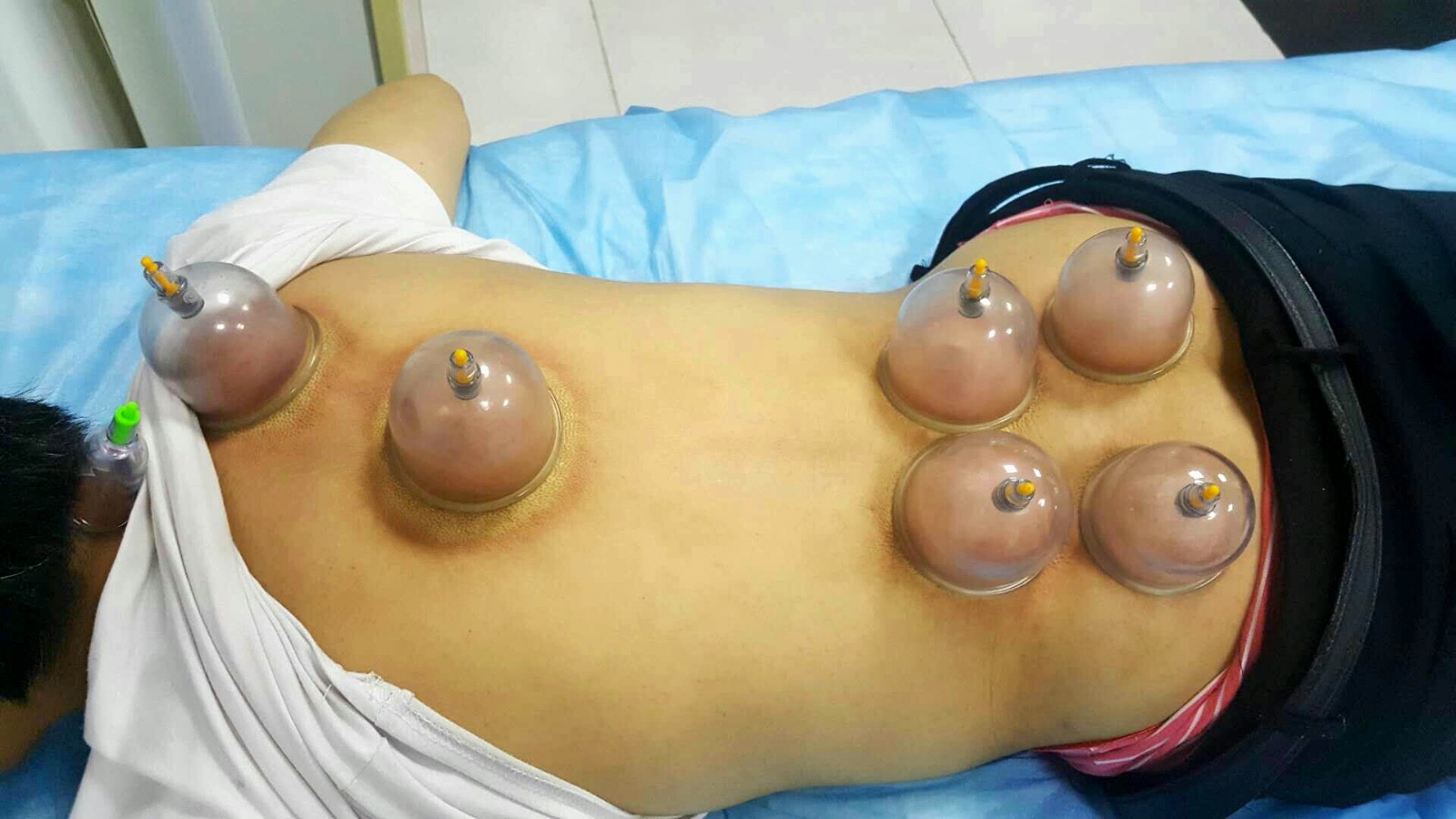 云南一中医独创风湿骨病新诊疗法：“五大绝招”治愈2千余患者