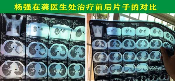 中国中医药传承人— 龚定军