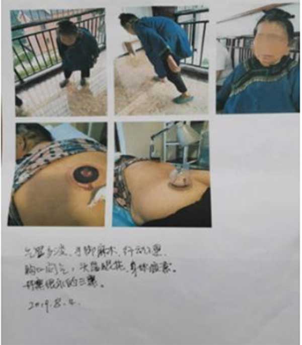 中国医学专家—— 黄力力