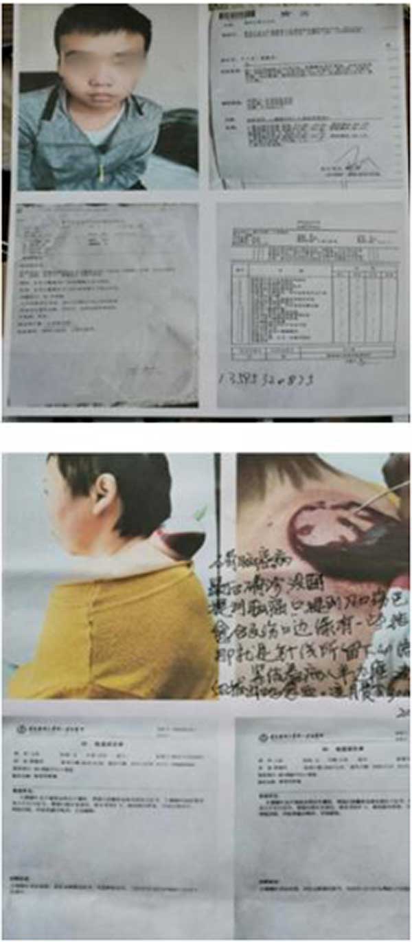 中国医学专家—— 黄力力