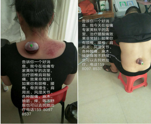 祛痛专家黄秋平——弘扬国粹施仁术 融汇古今铸医魂