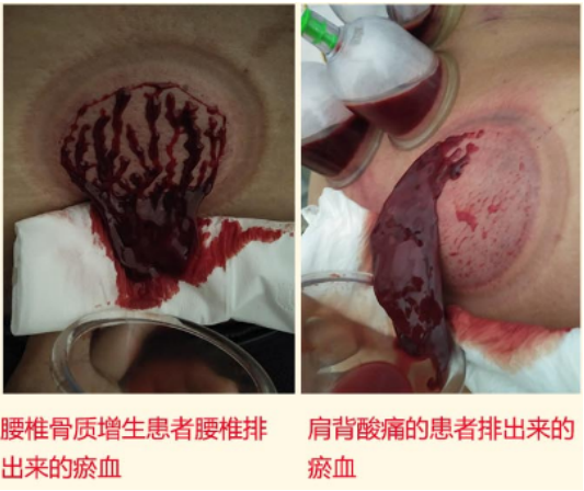 祛痛专家黄秋平——弘扬国粹施仁术 融汇古今铸医魂