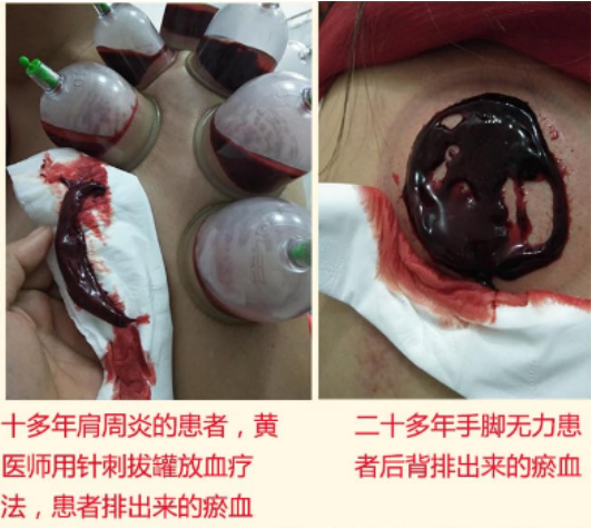 祛痛专家黄秋平——弘扬国粹施仁术 融汇古今铸医魂