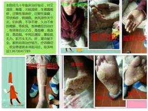 中国医药领路人—中医专家张其仁