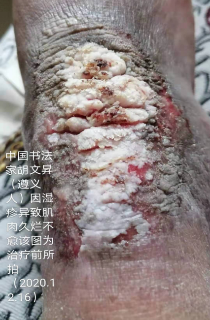 医学专家——黄明骏