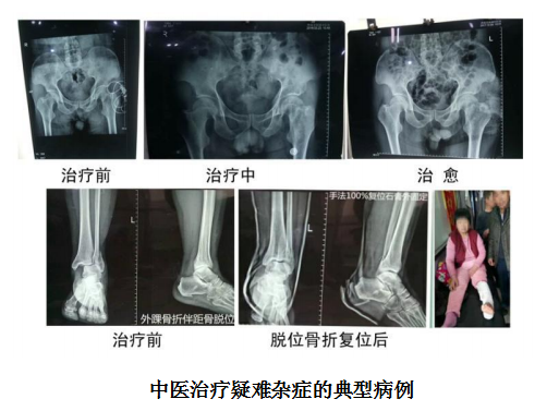 当代名医 — 黄静湖