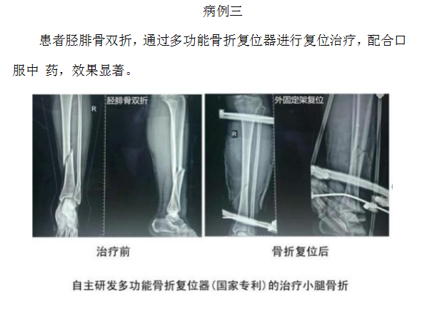当代名医 — 黄静湖