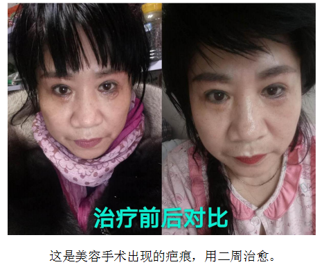 当代名医 — 黄静湖