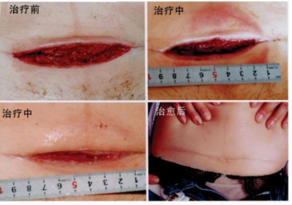 当代名医 — 黄静湖