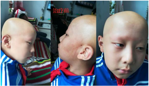 当代名医 — 黄静湖