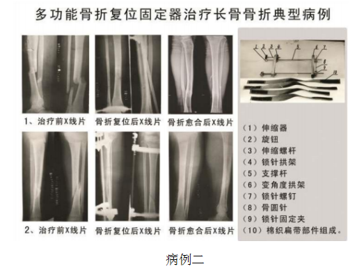 当代名医 — 黄静湖