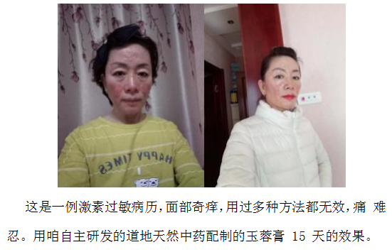 当代名医 — 黄静湖