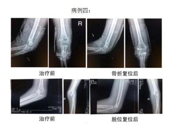 当代名医 — 黄静湖