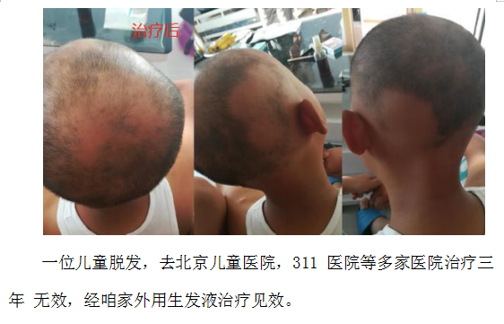 当代名医 — 黄静湖