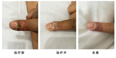 当代名医 — 黄静湖