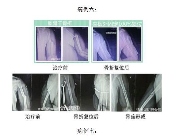 当代名医 — 黄静湖