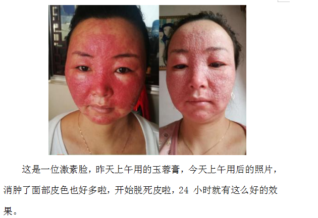 当代名医 — 黄静湖