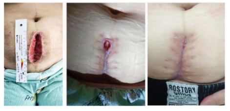 当代名医 — 黄静湖