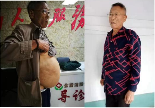 当代名医 — 黄静湖