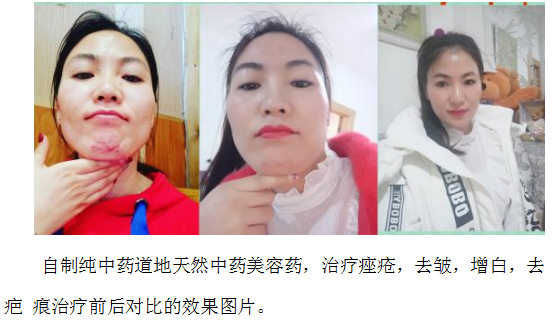 当代名医 — 黄静湖