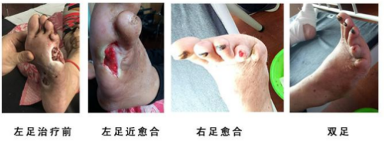 当代名医 — 黄静湖