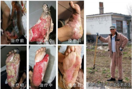 当代名医 — 黄静湖