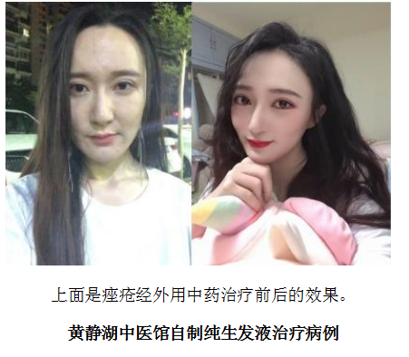 当代名医 — 黄静湖