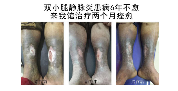 当代名医 — 黄静湖