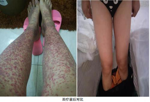 中医药传承人韩礼---辩证施治、守正创新(图18)