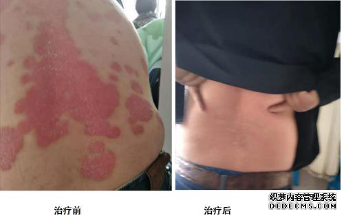 中医药传承人韩礼---辩证施治、守正创新(图16)