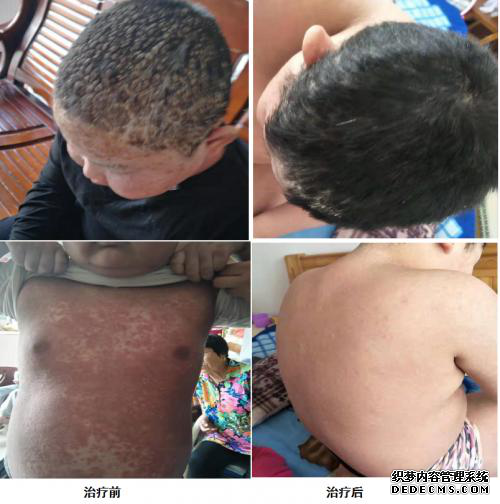 中医药传承人韩礼---辩证施治、守正创新(图15)