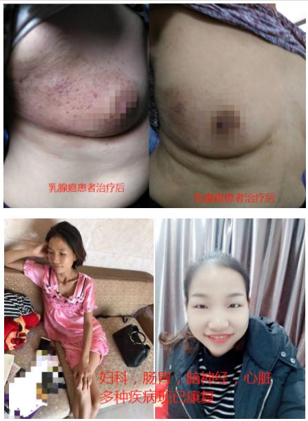 中国中医药传承人 —— 刘显科