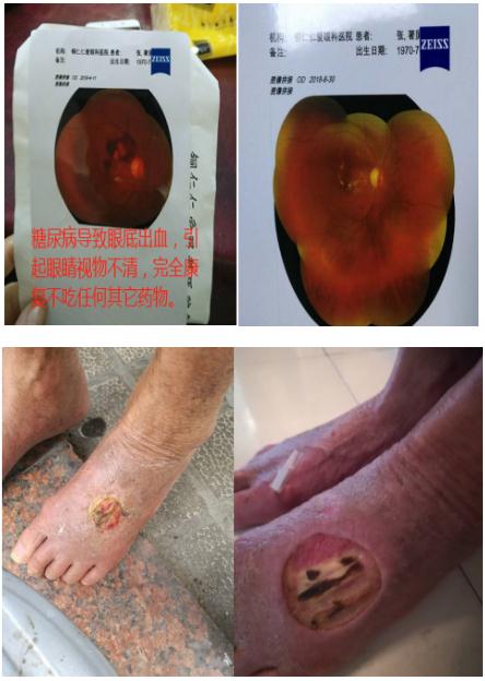 中国中医药传承人 —— 刘显科