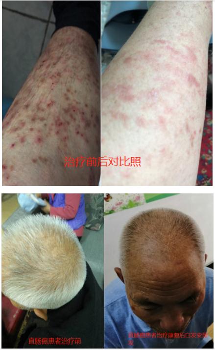 中国中医药传承人 —— 刘显科