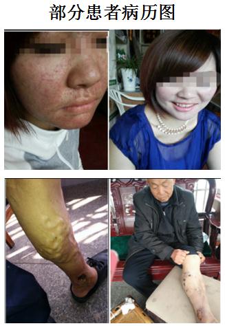 连氏中医第十一代传承人——连正福