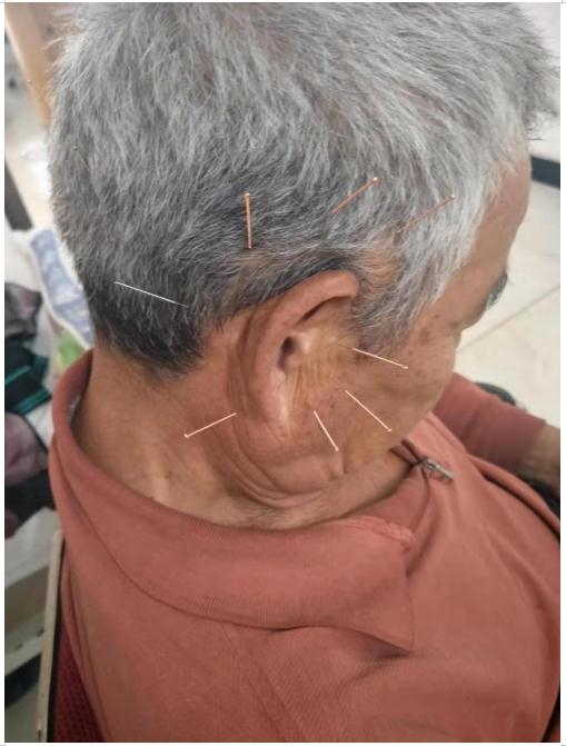 中国疑难病专家  ——   陈俊霖