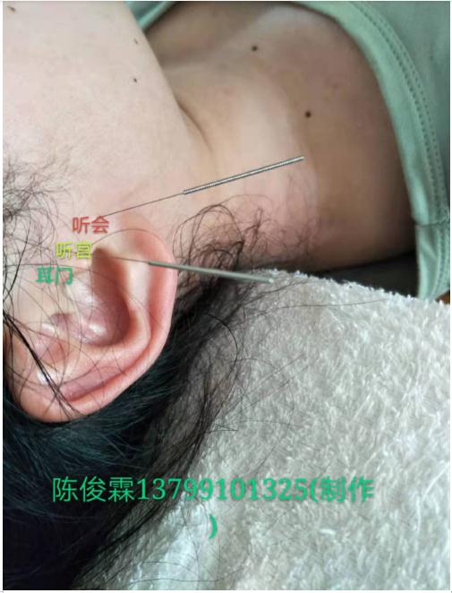 中国疑难病专家  ——   陈俊霖