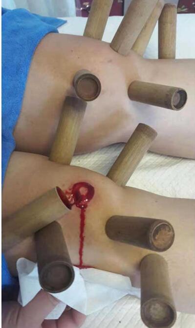 华医国粹传承人——肖波