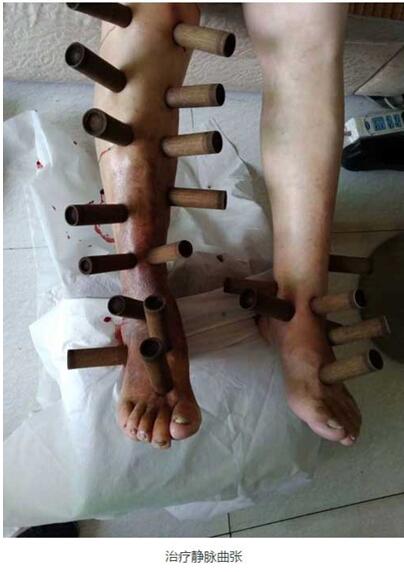 华医国粹传承人——肖波