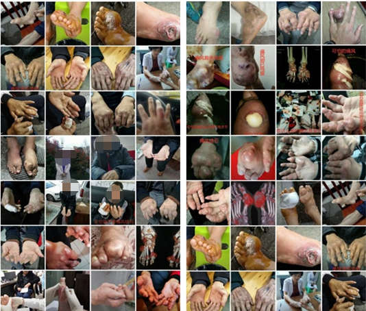 清镇苗九堂中医诊所段忠芬医师运用苗医精髓治疗各种疑难杂病