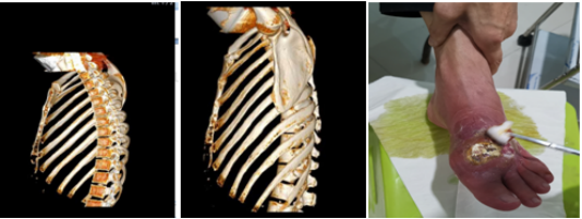 清镇苗九堂中医诊所段忠芬医师运用苗医精髓治疗各种疑难杂病