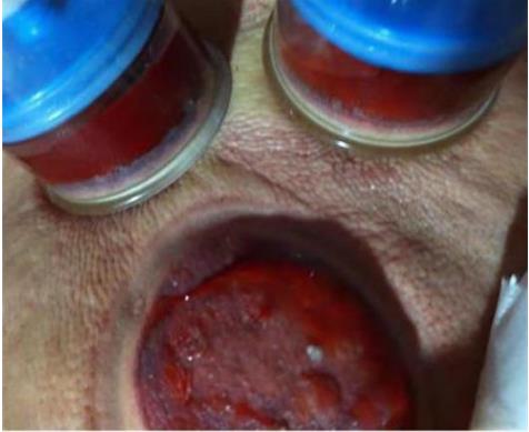 岐黄之道、吸透为本  ——黎阳、张德凤