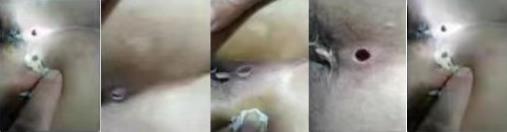 岐黄之道、吸透为本  ——黎阳、张德凤