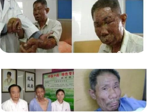 著名中医翟学礼