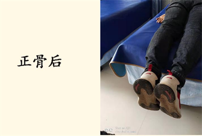 郜氏正骨传承人吴松功